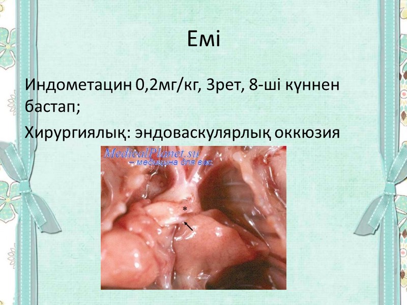 Емі Индометацин 0,2мг/кг, 3рет, 8-ші күннен бастап; Хирургиялық: эндоваскулярлық оккюзия